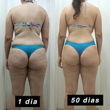 Antes e depois de Vanessa C. após seguir o plano alimentar