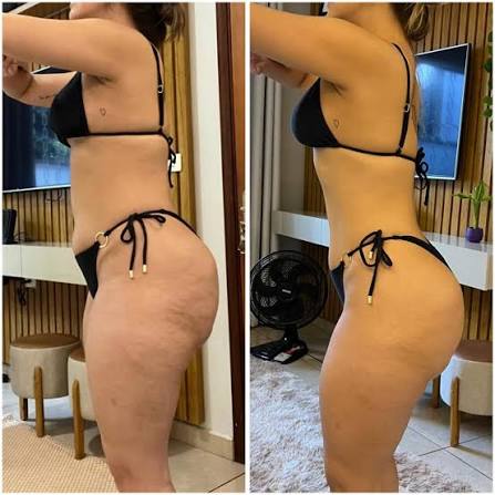 Antes e depois de Débora L. após seguir o plano alimentar